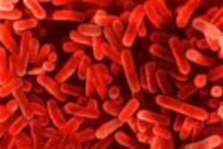 COVID et garantie des pertes d'exploitation due à la fermeture d'établissements